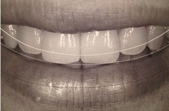 唇と歯の関係