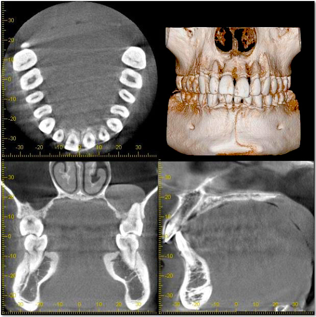 歯や顎の構造を分析